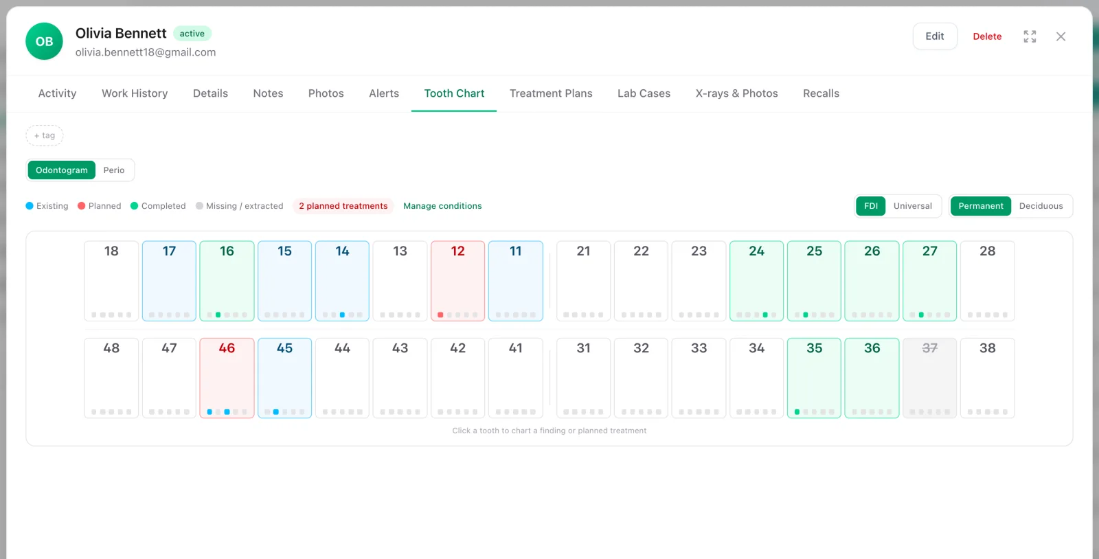 FDI tooth chart with existing, planned and completed findings